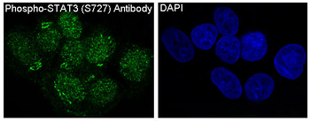 STAT3 (Phospho-Ser727) Rabbit mAb Antibody