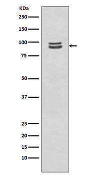 STAT3 (Phospho-Ser727) Rabbit mAb Antibody
