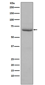 PKR (Phospho-Thr446) Rabbit mAb Antibody