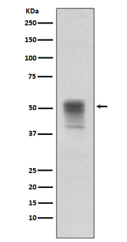 alpha Tubulin (Phospho-Tyr272) Rabbit mAb Antibody