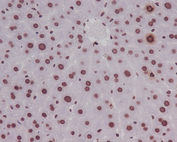 Histone H3 (Phospho-Ser10) Rabbit mAb Antibody