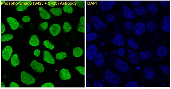 Smad3 (Phospho-Ser423/Ser425) Rabbit mAb Antibody