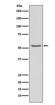 Smad3 (Phospho-Ser423/Ser425) Rabbit mAb Antibody
