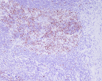 Histone H3 (Phospho-Thr3) Rabbit mAb Antibody