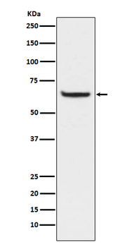 NF-κB p65 (Phospho-Ser529) Rabbit mAb Antibody
