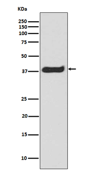 LAT (Phospho-Tyr220) Rabbit mAb Antibody