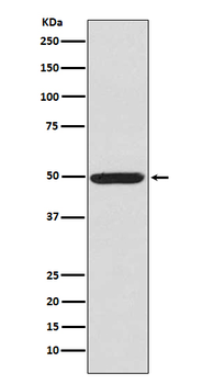 PKA R2 (Phospho-Ser99) Rabbit mAb Antibody