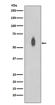 c-Myc (Phospho-Thr58/Ser62) Rabbit mAb Antibody