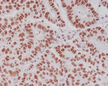 Creb (Phospho-Ser133) Rabbit mAb Antibody