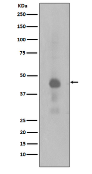 Creb (Phospho-Ser133) Rabbit mAb Antibody