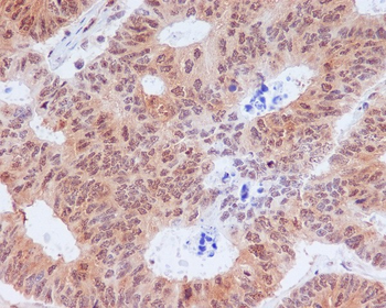 eIF2 alpha (Phospho-Ser51) Rabbit mAb Antibody