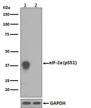 eIF2 alpha (Phospho-Ser51) Rabbit mAb Antibody