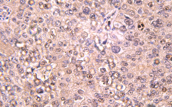 Recombinant IL6 Rabbit mAb(G12) Antibody