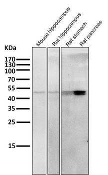 Cytokeratin-20 Antibody