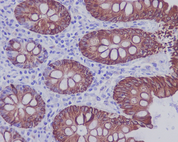 Cytokeratin-20 Antibody
