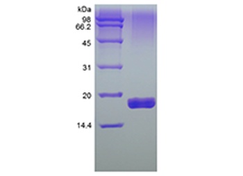 Recombinant Human soluble Tumor Necrosis Factor-Related Apoptosis-inducing Ligand Receptor-2/TNFRSF10B