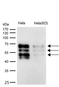 BIN1 Rabbit mAb [KD Validated] Antibody