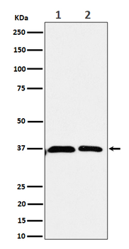 Serine racemase Rabbit Monoclonal Antibody