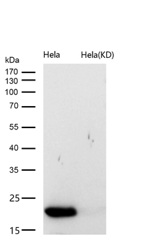 UFC1 Rabbit mAb [KD Validated] Antibody