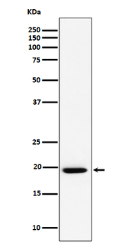 UFC1 Rabbit mAb [KD Validated] Antibody