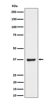 RNF115 Rabbit mAb Antibody