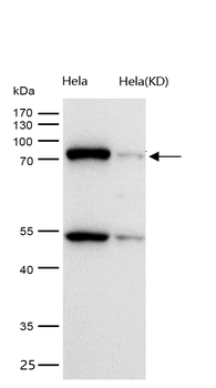 ACAP2 Rabbit mAb [KD Validated] Antibody