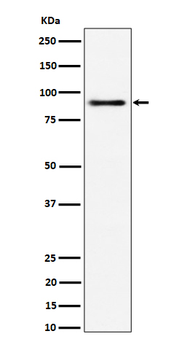 ACAP2 Rabbit mAb [KD Validated] Antibody