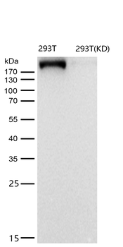 IQGAP2 Rabbit mAb [KD Validated] Antibody