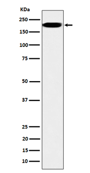 IQGAP2 Rabbit mAb [KD Validated] Antibody