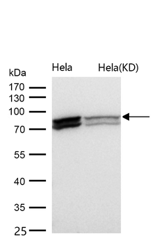 HNRNPM Rabbit mAb [KD Validated] Antibody