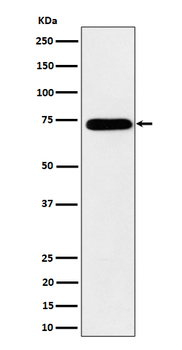 HNRNPM Rabbit mAb [KD Validated] Antibody