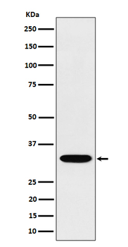 TSFM Rabbit mAb [KD Validated] Antibody