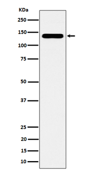 CYFIP1 Rabbit mAb [KD Validated] Antibody