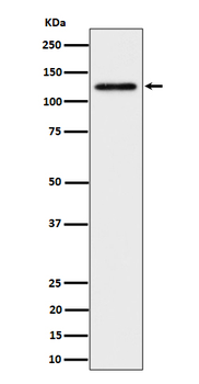 SPINK5 / LEKTI Rabbit mAb [KD Validated] Antibody