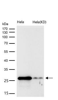Galectin 3 Rabbit mAb [KD Validated] Antibody
