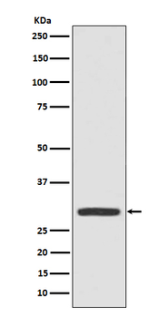 Galectin 3 Rabbit mAb [KD Validated] Antibody