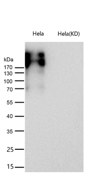 Fibronectin Rabbit mAb [KD Validated] Antibody
