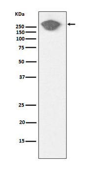 Fibronectin Rabbit mAb [KD Validated] Antibody