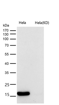 Histone H3 (acetyl K18) Rabbit mAb [KD Validated] Antibody