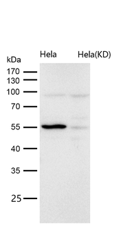 LMAN1 Rabbit mAb [KD Validated] Antibody