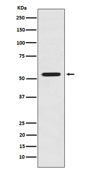LMAN1 Rabbit mAb [KD Validated] Antibody