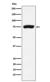 XPD Rabbit Monoclonal Antibody