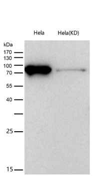 PLAP Rabbit mAb [KD Validated] Antibody