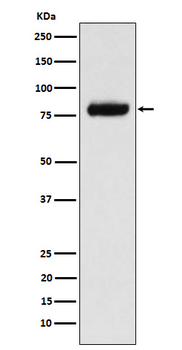 PLAP Rabbit mAb [KD Validated] Antibody