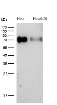 Poliovirus Receptor Rabbit mAb [KD Validated] Antibody