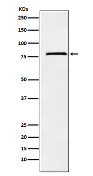 NDUFS1 Rabbit mAb Antibody