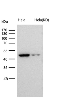 IDH1 Rabbit mAb [KD Validated] Antibody