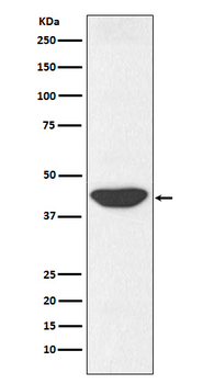 IDH1 Rabbit mAb [KD Validated] Antibody