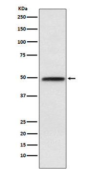 NFIB / NF1B2 Rabbit mAb Antibody