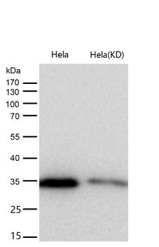 GNB2 Rabbit Monoclonal Antibody